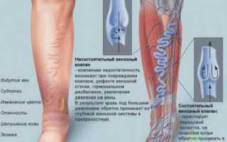 Почему появляются боли при месячных: причины недомогания