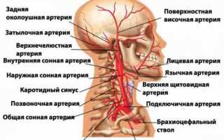 Нестенозирующий и стенозирующий атеросклероз БЦА – что это такое, симптомы и лечение