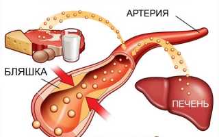 Симптомы сахарного диабета у женщин после 60 лет