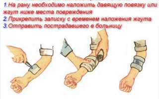 Оказание первой помощи при венозном кровотечении