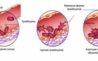 Тромбоциты понижены у взрослого: о чем это говорит