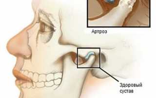 Причины боли в челюсти при открывании рта и жевании, что делать