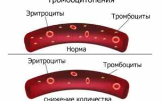 Тромбоциты понижены у взрослого, о чем это говорит, и как лечиться?