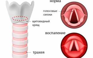 Болит горло с одной стороны — опасно ли это и что делать
