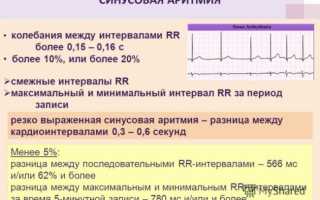 Расшифровка ЭКГ