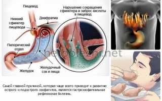 Ощущение кома в горле: что это может быть, вероятные причины, как избавиться