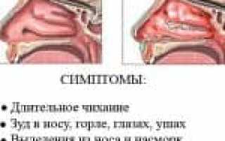 Корень солодки от кашля – инструкция по применению сиропа