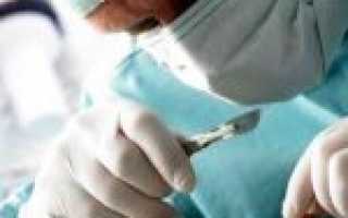 Способы выпрямить нос после перелома