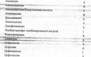 Для чего делают мазок из носа: показания к исследованию, что можна выявить, расшифровка