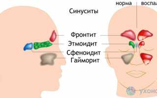 Искривление носовой перегородки — причины, виды, симптомы, последствия, методы лечения