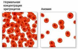 Ретикулоциты. Норма у женщин, мужчин, детей в крови по возрасту, таблица, расшифровка анализа