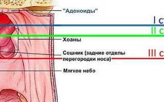 Хлорофиллипт при аденоидах