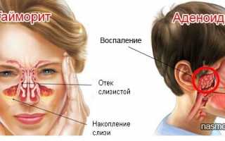 Причины появления соплей у взрослых и детей