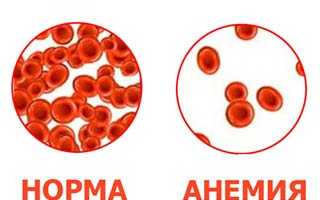 Понижены эритроциты в крови у мужчин и женщин