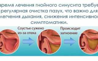 Последствия гайморита и осложнения недолеченного заболевания у взрослых