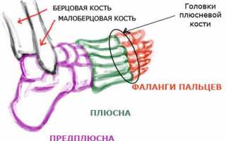 Что такое артроз стопы — симптомы и лечение, причины, как лечить заболевание ног