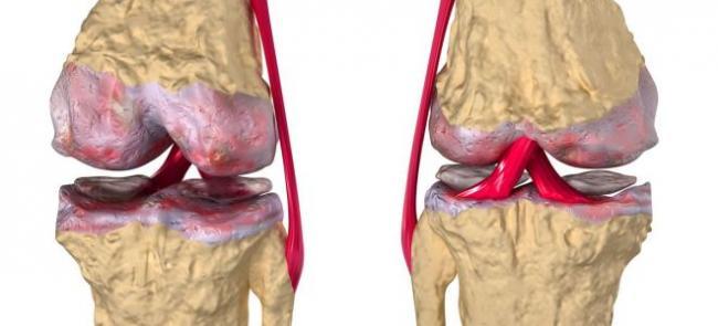 9a4e1759c_660x300.jpg