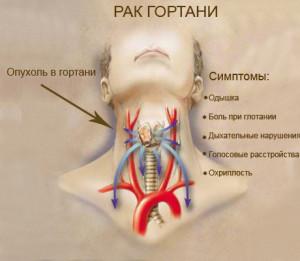 RAK_GORTANI-300x261.jpg