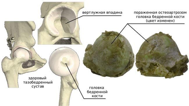 Golovka.jpg