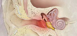 otit-simptomy-i-lechenie.jpg