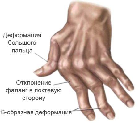 1-78-450x397.jpg