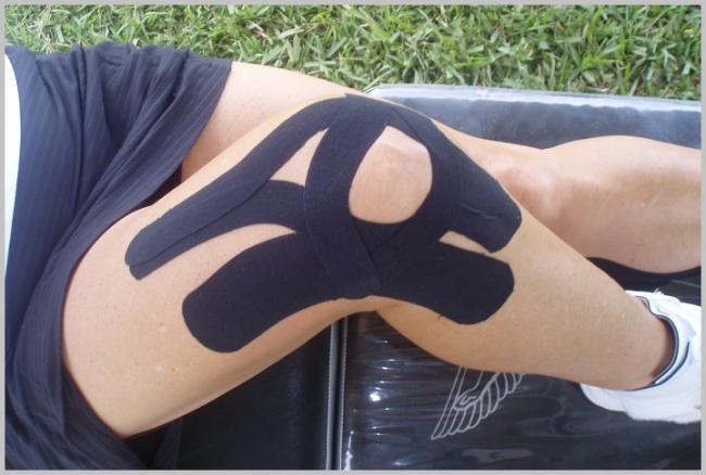 kinesio-tape-1-1.jpg