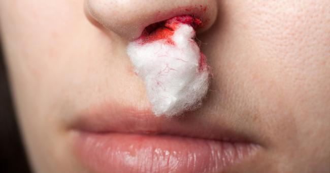 спровоцировать кровотечение из носа