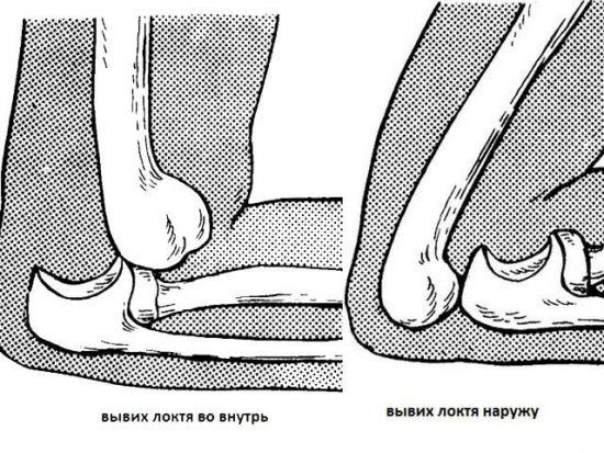 bl-lokot-1-550x413.jpg