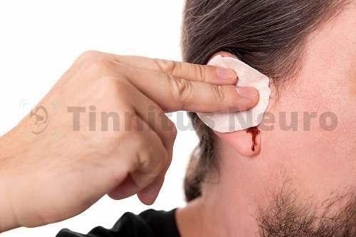 travma-uha.jpg