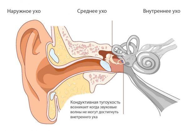 konduktivnaya-tugouhost-1148x800-600x418.jpg