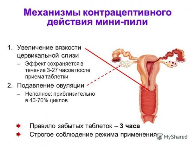 действие мини-пили