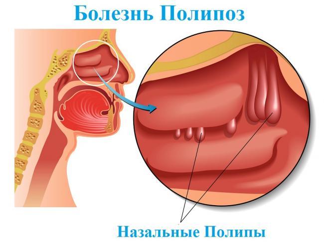 24601191_l.jpg