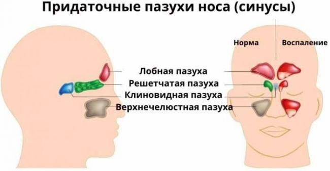 Pridatochnye-pazuhi-nosa_2.jpg