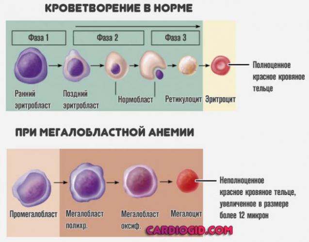 krovetvorenie-po-megaloblastnomu-tipu.jpg