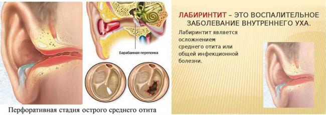 Labirintit-i-otit.jpg