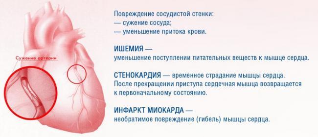 ishemiya-serdechnoj-myshczy-1024x443.jpg