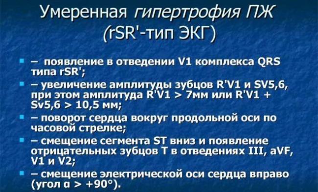 umerennaya-gipertrofiya-1-e1500274590380.jpg