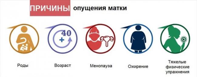 причины опущения матки