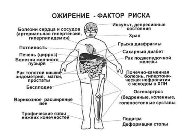 Deformiruyushhij-artroz-1-stepeni-kolennogo-sustava.jpg