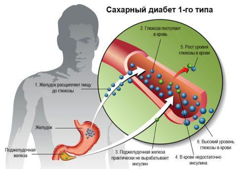 insulin_ponizhen_diabet-480x343.jpg