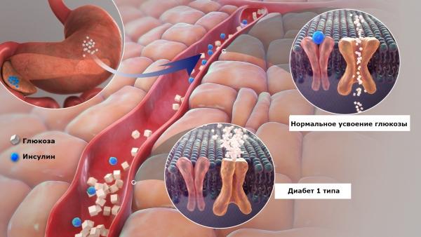 3D_medical_animation_still_of_Diabetes_600x338.jpg