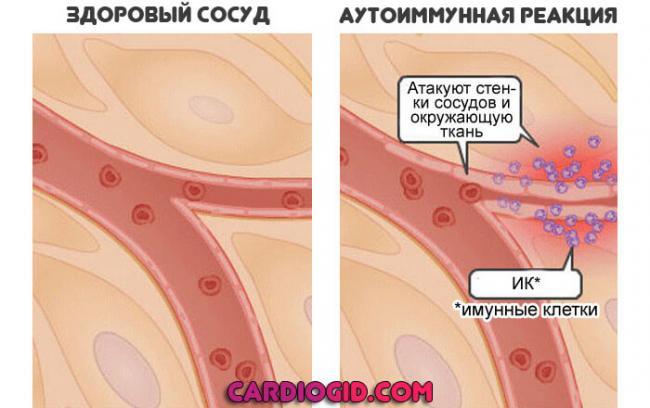 autoimmunnaya-reaktsiya.jpg