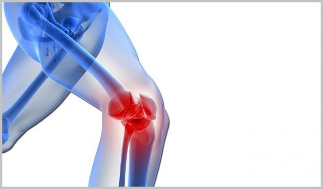 kneepain2.jpg