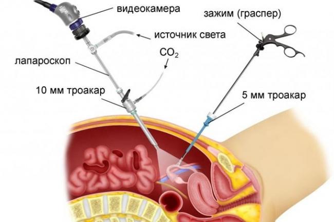 диагностика в гинекологии