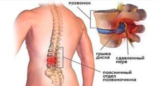 Скриншот-23-11-2017-001903-678x371-320x175.png