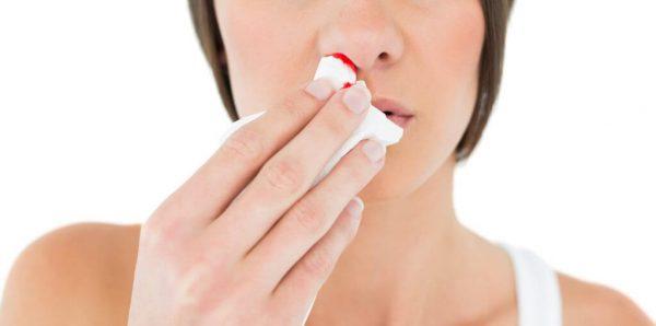 nasal-bleeding-600x298.jpg