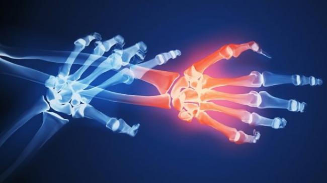 Is-Hand-Numbness-A-Symptom-of-Arthritis-1440x810.jpg