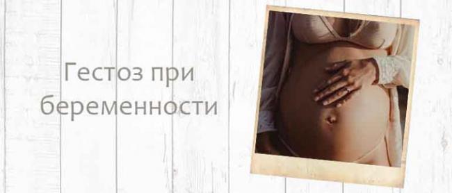 гестоз беременных