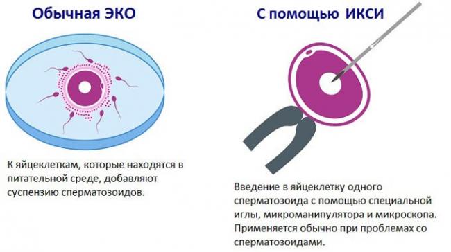 икси как проводится