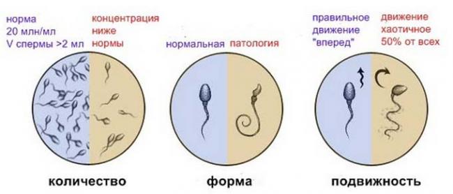 нормальные показатели спермограммы
